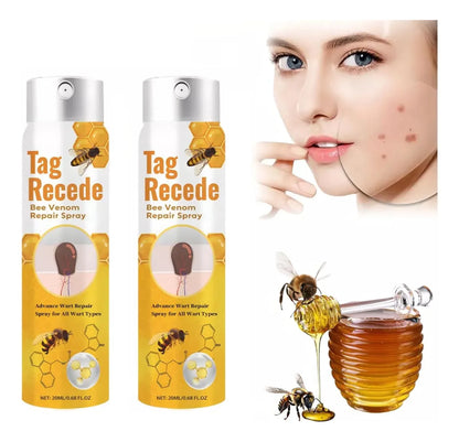 Elimina verrugas visibles sin dolorosos procedimientos clínicos