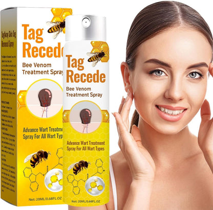 Elimina verrugas visibles sin dolorosos procedimientos clínicos